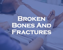 Broken Bones And Fractures - doctor setting a cast around a leg