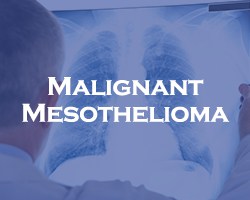 Malignant Mesothelioma - blue over a doctor looking a an x-ray of lungs